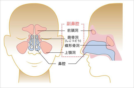 副鼻腔炎