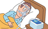 CPAP（シーパップ）療法＞(保険診療)